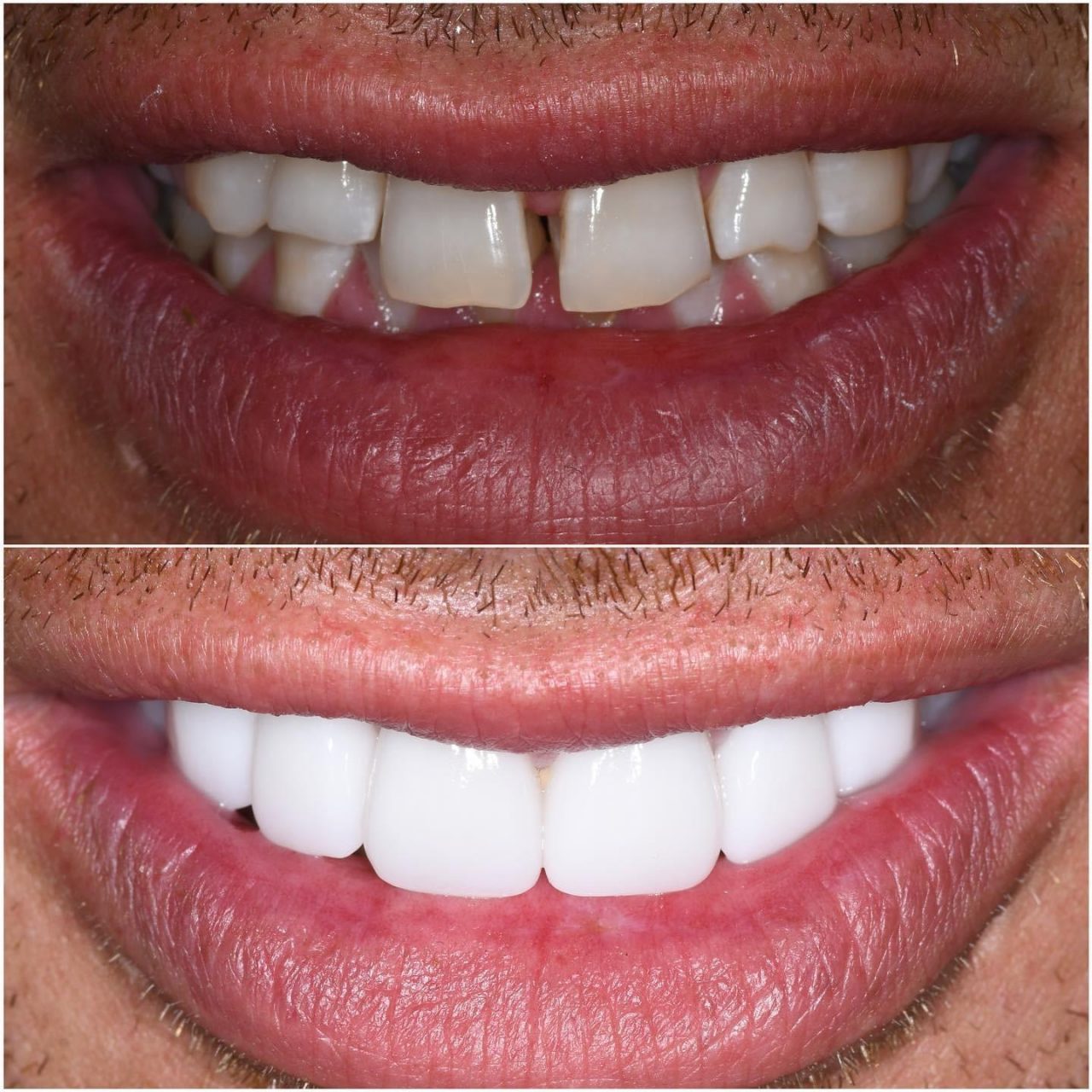 Overseas Dental Prices Melbourne Value Dental Centres