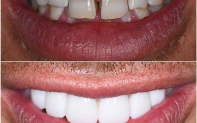 Unlock the Full Potential of Your Smile with Cosmetic Dentistry