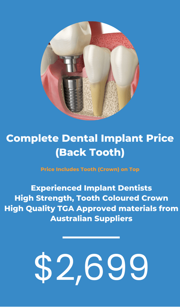 Dental Implants Information Melbourne Value Dental Centres