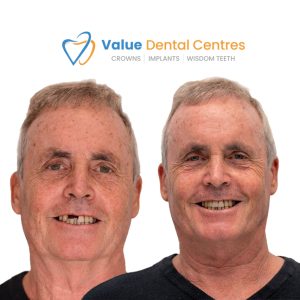 cosmetic dentistry improves your smile and confidence
