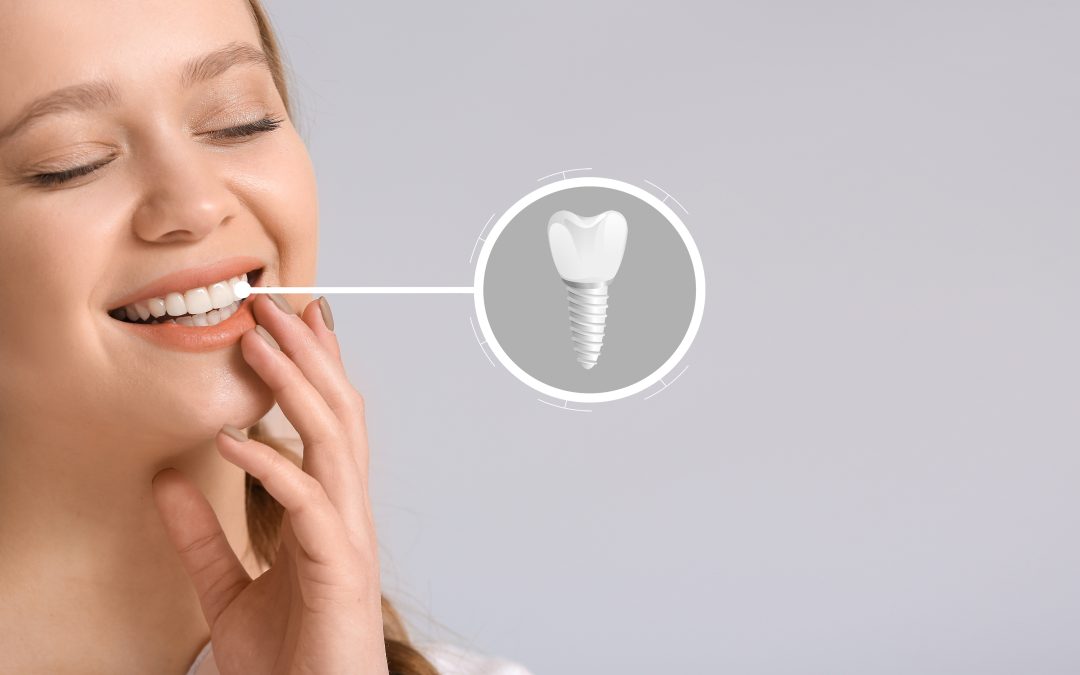 Love Your Smile With Dental Implants