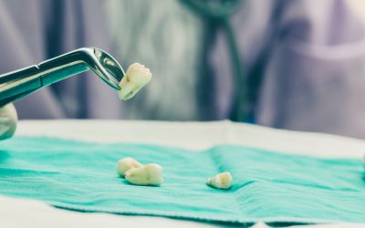 Tooth Extractions Aren’t Just For Wisdom Teeth!