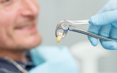 Post-Tooth Extraction Care Tips You Need To Know