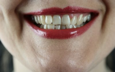 Maintaining Your Dental Bridge: Tips for Long-Term Success