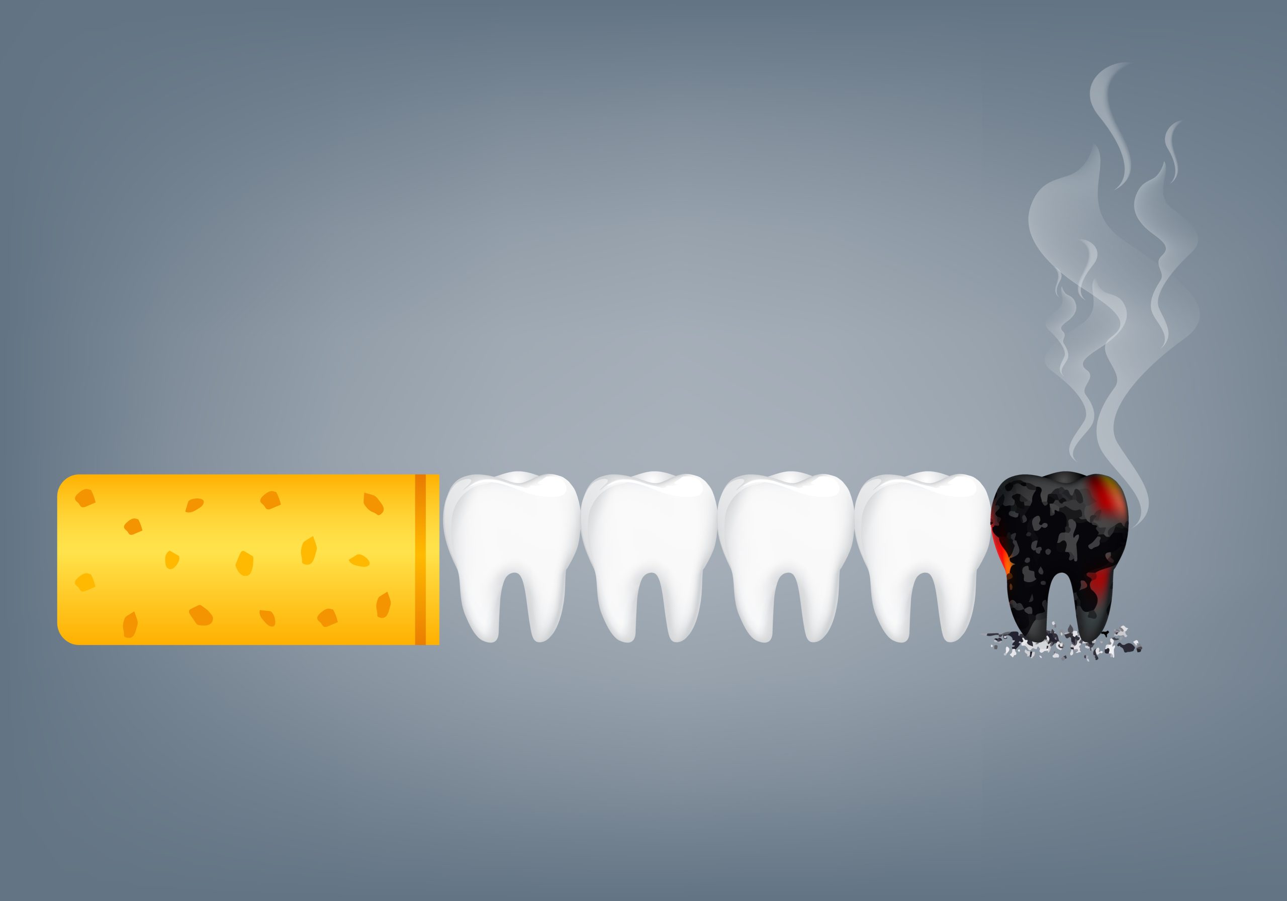 Impact of smoking on oral health