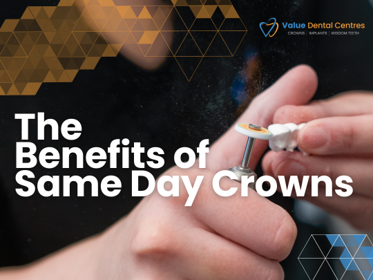 From Consultation to Crown in 2 Hours: The Benefits of Same-Day Crowns