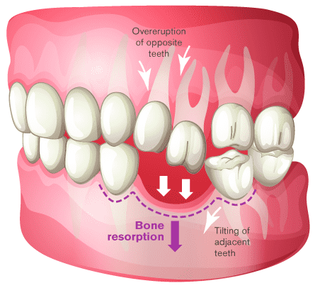 teeth reconstruction