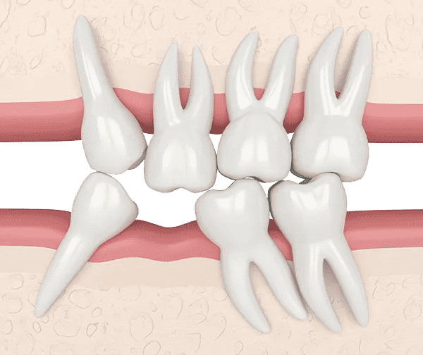 teeth reconstruction